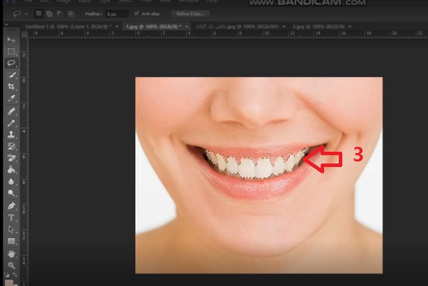 (نحوه سفيد كردن دندان در فتوشاپ| کمک کامپیوتر تلفنی)