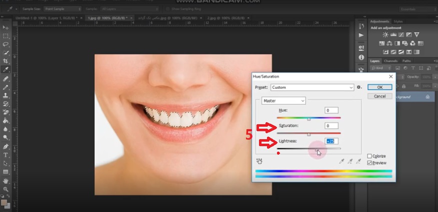 (فتوشاپ دندان در عکس| کمک کامپیوتر تلفنی)